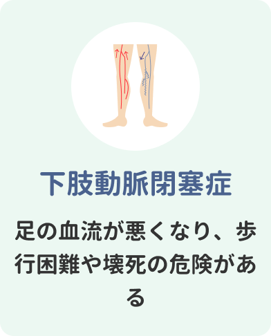 下肢動脈閉塞症　足の血流が悪くなり、歩行困難や壊死の危険がある