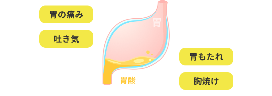 胃の痛み、吐き気、胃もたれ、胸焼け