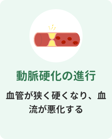 動脈硬化の進行　血管が狭く硬くなり、血流が悪化する