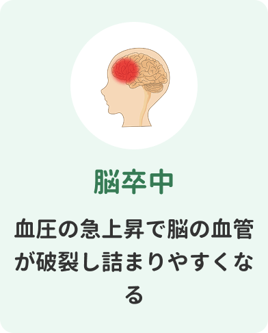 脳卒中　血圧の急上昇で脳の血管が破裂し詰まりやすくなる