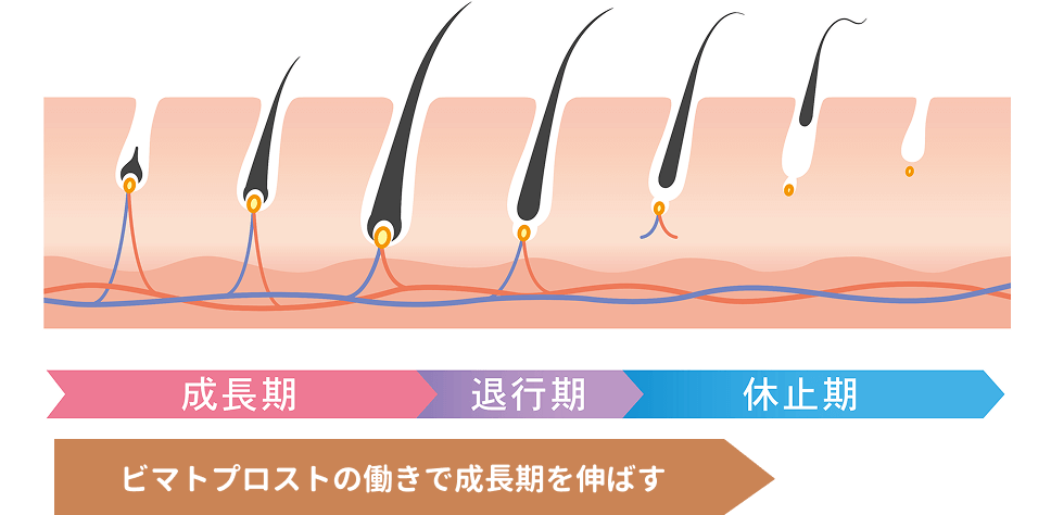 ビマトプロストの働きで成長期を伸ばす